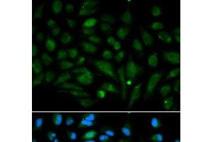 Immunofluorescence analysis of MCF-7 cells using Decorin Polyclonal Antibody (Decorin Antikörper)