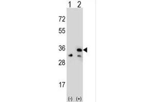 Western blot analysis of VDAC1 (arrow) using rabbit polyclonal VDAC1 Antibody (Center) (ABIN390564 and ABIN2840894). (VDAC1 Antikörper  (AA 95-124))
