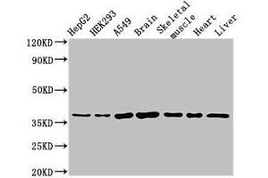 Western Blot Positive WB detected in: HepG2 whole cell lysate, HEK293 whole cell lysate, A549 whole cell lysate, Mouse brain tissue, Mouse skeletal muscle tissue, Rat heart tissue, Rat liver tissue All lanes: MYF6 antibody at 3 μg/mL Secondary Goat polyclonal to rabbit IgG at 1/50000 dilution Predicted band size: 27 kDa Observed band size: 37 kDa (MYF6 Antikörper  (AA 26-232))