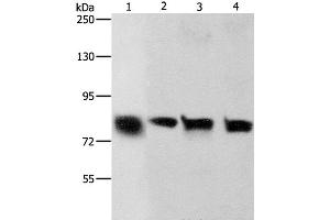 Western Blot analysis of Hela and A549 cell, Human liver cancer tissue and HT-29 cell using K-Cadherin Polyclonal Antibody at dilution of 1:500 (CDH6 Antikörper)