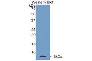 Western Blotting (WB) image for anti-Interleukin 18 Receptor 1 (IL18R1) (AA 375-428) antibody (ABIN1859374) (IL18R1 Antikörper  (AA 375-428))
