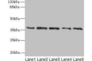 Western blot All lanes: PLAUR antibody at 4 μg/mL Lane 1: Mouse brain tissue Lane 2: A2780 whole cell lysate Lane 3: MCF-7 whole cell lysate Lane 4: Hela whole cell lysate Lane 5: Colo320 whole cell lysate Secondary Goat polyclonal to rabbit IgG at 1/10000 dilution Predicted band size: 37, 32, 33 kDa Observed band size: 37 kDa (PLAUR Antikörper  (AA 23-305))