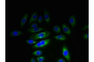 Immunofluorescent analysis of A549 cells using ABIN7157483 at dilution of 1:100 and Alexa Fluor 488-congugated AffiniPure Goat Anti-Rabbit IgG(H+L) (KHDC1 Antikörper  (AA 74-237))