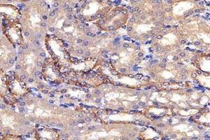 Immunohistochemistry (Paraffin-embedded Sections) (IHC (p)) image for anti-Proteasome (Prosome, Macropain) 26S Subunit, Non-ATPase, 8 (PSMD8) antibody (ABIN7075226)