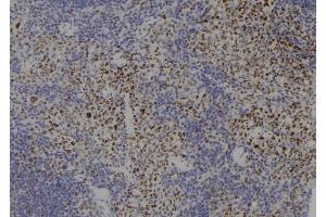 ABIN6277766 at 1/100 staining Mouse spleen tissue by IHC-P. (SMC3 Antikörper  (C-Term))
