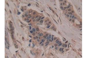 Immunohistochemistry (IHC) image for anti-CD200 (CD200) (AA 31-232) antibody (ABIN7432826)