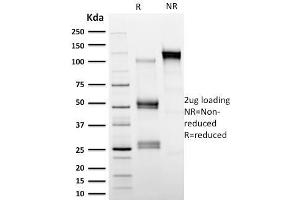 SDS-PAGE Analysis Purified Calpastatin Mouse Monoclonal Antibody (CAST/1550). (Calpastatin Antikörper)