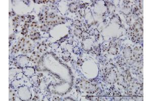 Immunostaining (ISt) image for anti-Nuclear Factor I/C (CCAAT-Binding Transcription Factor) (NFIC) (AA 1-428) antibody (ABIN561976)