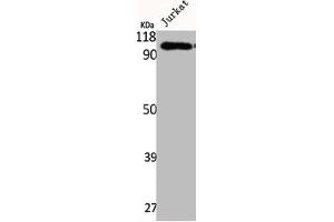 Western Blot analysis of Jurkat cells using Integrin β5 Polyclonal Antibody (Integrin beta 5 Antikörper  (C-Term))