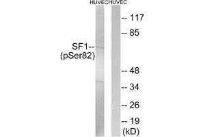 Western blot analysis of extracts from HUVEC cells treated with anisomycin using SF1 (Phospho-Ser82) Antibody. (Splicing Factor 1 Antikörper  (pSer82))
