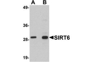 Western blot analysis of SIRT6 in HeLa cell lysate with SIRT6 antibody at (A) 0. (SIRT6 Antikörper  (C-Term))
