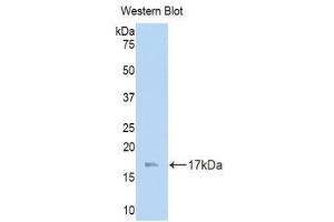 Western Blotting (WB) image for anti-Laminin, gamma 3 (LAMC3) (AA 751-875) antibody (ABIN1859608) (LAMC3 Antikörper  (AA 751-875))