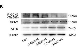 BCAA increase PPAR-α expression in a GCN2/ATF6 pathway-dependent manner. (beta Actin Antikörper)