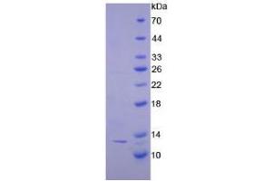 SDS-PAGE analysis of Human CTNNbIP1 Protein. (CTNNBIP1 Protein)
