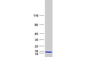 Chromosome 17 Open Reading Frame 103 (C17ORF103) protein (Myc-DYKDDDDK Tag)
