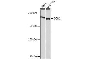 Western blot analysis of extracts of various cell lines, using GCN2 Rabbit mAb (ABIN1679532, ABIN3015972, ABIN3015973 and ABIN7101471) at 1:1000 dilution. (GCN2 Antikörper)