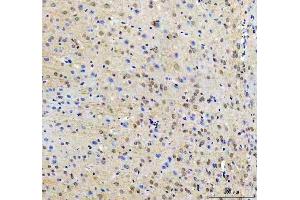 IHC analysis of RTF1 using anti-RTF1 antibody (ABIN7602444). (RTF1 Antikörper  (AA 77-705))