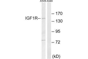 Western Blotting (WB) image for anti-Insulin-Like Growth Factor 1 Receptor (IGF1R) (Tyr1346) antibody (ABIN1848190) (IGF1R Antikörper  (Tyr1346))