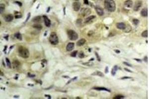 Image no. 3 for anti-Nibrin (NBN) (pSer343) antibody (ABIN318326) (Nibrin Antikörper  (pSer343))