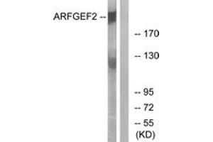 Western blot analysis of extracts from A549 cells, using ARFGEF2 Antibody.