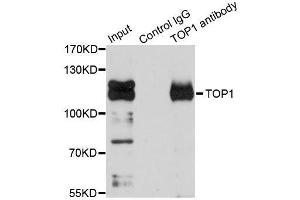Immunoprecipitation analysis of 150ug extracts of Jurkat cells using 3ug TOP1 antibody. (Topoisomerase I Antikörper  (AA 1-100))
