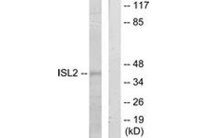 Western Blotting (WB) image for anti-ISL LIM Homeobox 2 (ISL2) (AA 161-210) antibody (ABIN2889718) (ISL2 Antikörper  (AA 161-210))