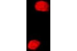 Immunofluorescent analysis of SETD5 staining in MCF7 cells. (SETD5 Antikörper)