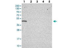 Western blot analysis of Lane 1: RT-4, Lane 2: U-251 MG, Lane 3: Human Plasma, Lane 4: Liver, Lane 5: Tonsil with C19orf47 polyclonal antibody  at 1:100-1:250 dilution. (C19orf47 Antikörper)