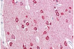 Anti-PACSIN1 antibody IHC staining of human brain, cortex. (PACSIN1 Antikörper  (AA 2-15))