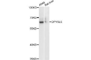 Western blot analysis of extracts of various cell lines, using DPYSL5 antibody (ABIN6291929) at 1:3000 dilution. (DPYSL5 Antikörper)