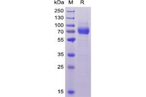 Human CD33, hFc-His Tag on SDS-PAGE under reducing condition. (CD33 Protein (CD33) (Fc-His Tag))