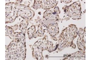 Image no. 1 for anti-Testis-Specific Kinase 2 (TESK2) (AA 405-542) antibody (ABIN466168) (TESK2 Antikörper  (AA 405-542))