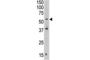 Western Blotting (WB) image for anti-Septin 9 (SEPT9) antibody (ABIN3002552) (Septin 9 Antikörper)
