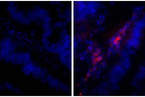 Paraffin embedded human gastric cancer tissue was stained with Rabbit IgG-UNLB isotype control and DAPI. (Kaninchen anti-Human IgG Antikörper (Biotin))