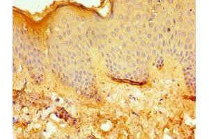 Immunohistochemistry of paraffin-embedded human skin tissue using ABIN7171956 at dilution of 1:100 (ERCC2 Antikörper  (AA 1-300))