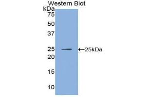 Western Blotting (WB) image for anti-Inhibitor of KB Kinase beta Interacting Protein (IKbIP) (AA 132-314) antibody (ABIN1859323)