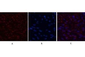 Immunofluorescence analysis of human breast cancer tissue.