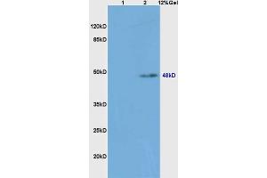 Lane 1: mouse spleen lysates Lane 2: mouse liver lysates probed with Anti caspase-8 subunit p18 Polyclonal Antibody, Unconjugated (ABIN1386778) at 1:200 in 4 °C. (Caspase 8 Antikörper  (AA 188-280))