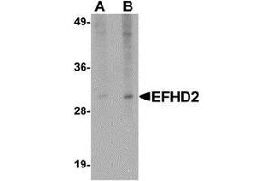 Western blot analysis of EFHD2 in mouse brain tissue lysate with AP30310PU-N EFHD2 antibody at (A) 1 and (B) 2 μg/ml. (EFHD2 Antikörper  (N-Term))