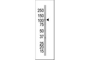 EPH Receptor A7 Antikörper  (C-Term)