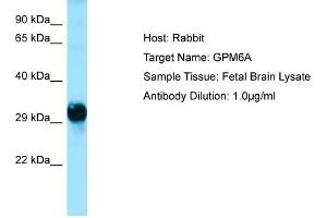 Host: Rabbit  Target Name: GPM6A  Antibody Dilution: 1.