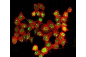 IF analysis of ADAR1/ADAR using anti-ADAR1/ADAR antibody (ABIN7598956) and Anti-Beta Tubulin Antibody (ABIN7602743).