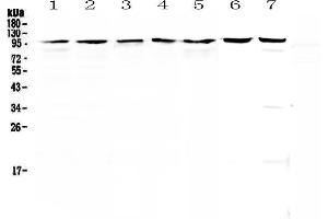 Western blot analysis of Topoisomerase I using anti-Topoisomerase I antibody . (Topoisomerase I Antikörper  (AA 526-765))