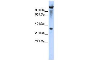 RNASET2 antibody used at 1 ug/ml to detect target protein. (RNASET2 Antikörper  (Middle Region))