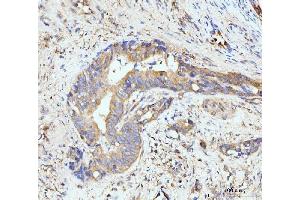 IHC analysis of GIT1 using anti-GIT1 antibody (ABIN7601683). (GIT1 Antikörper  (AA 415-736))