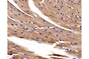IHC analysis of ACTN2 using anti-ACTN2 antibody (ABIN7602055). (ACTN2 Antikörper  (AA 567-696))