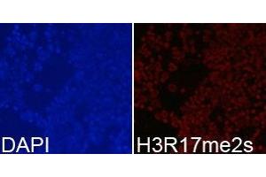Immunofluorescence analysis of 293T cell using H3R17me2s antibody. (Histone 3 Antikörper  (H3R17me2s))