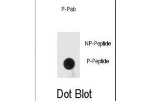 Dot Blot (DB) image for anti-Protein Kinase, Interferon-Inducible Double Stranded RNA Dependent Activator (PRKRA) (pSer246) antibody (ABIN3001881) (PRKRA Antikörper  (pSer246))