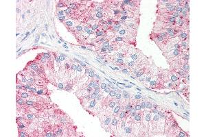 Anti-SLC39A14 antibody IHC of human prostate. (SLC39A14 Antikörper  (Internal Region))