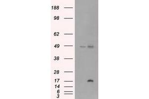 Image no. 1 for anti-Cancer/testis Antigen 1B (CTAG1B) antibody (ABIN1499904) (CTAG1B Antikörper)